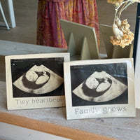 MARCO ECOGRAFÍA BEBÉ