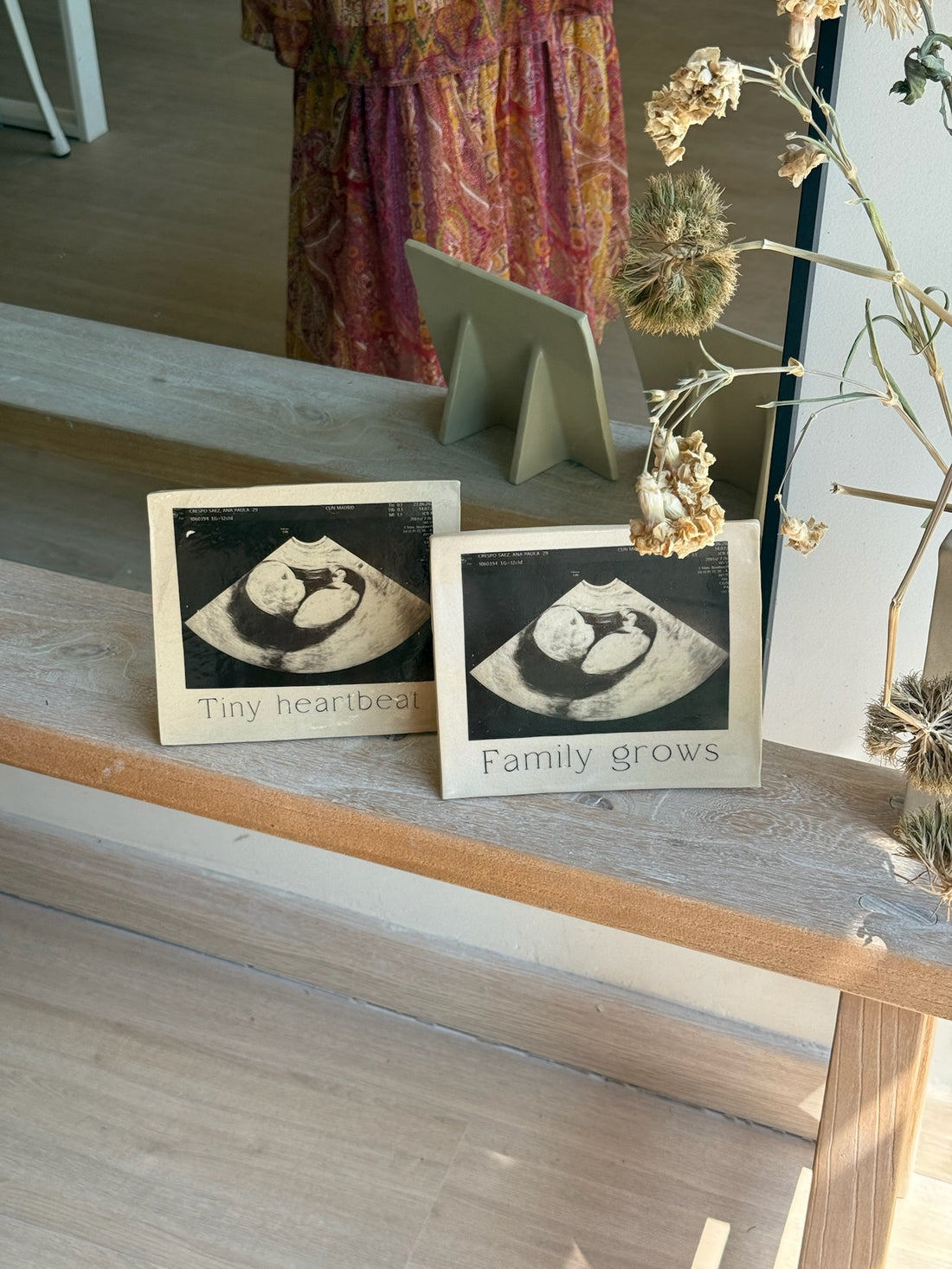 MARCO ECOGRAFÍA BEBÉ