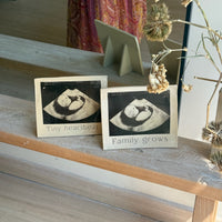 MARCO ECOGRAFÍA BEBÉ