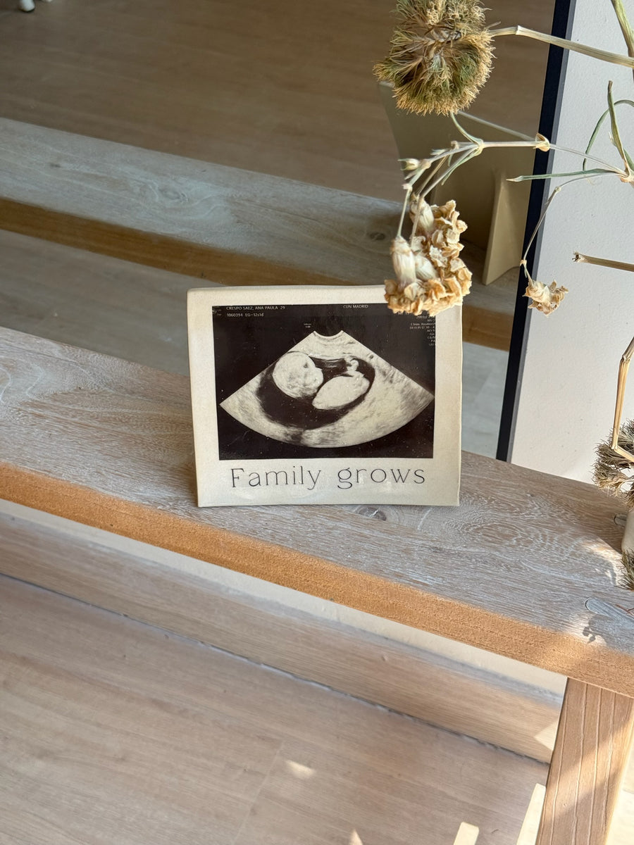 MARCO ECOGRAFÍA BEBÉ