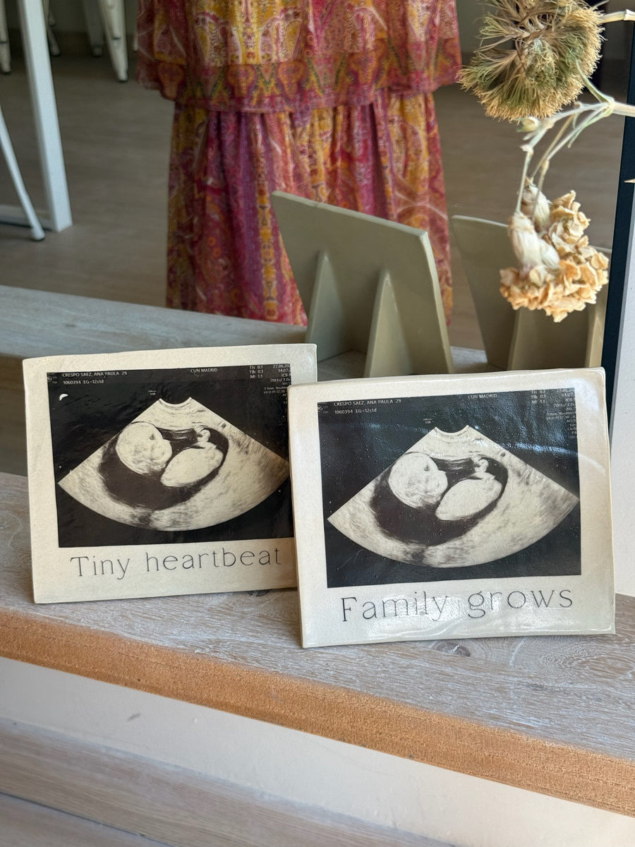 MARCO ECOGRAFÍA BEBÉ