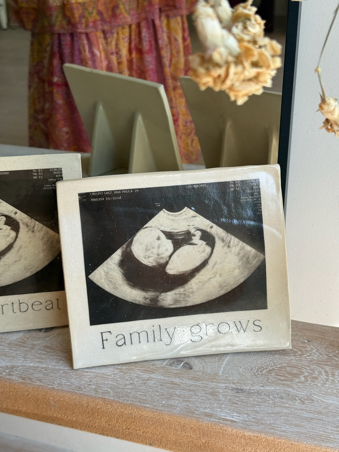 MARCO ECOGRAFÍA BEBÉ