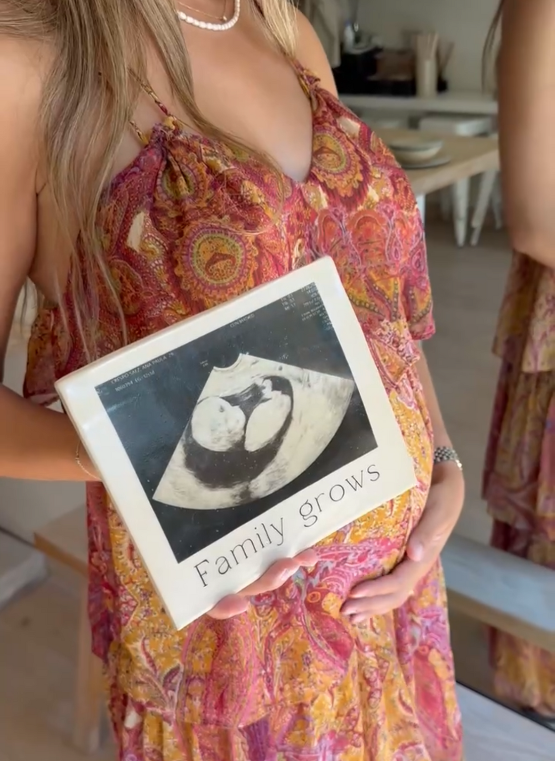 MARCO ECOGRAFÍA BEBÉ