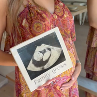 MARCO ECOGRAFÍA BEBÉ